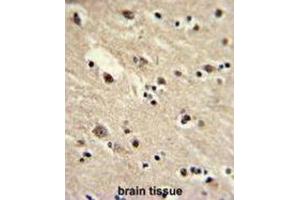 Immunohistochemistry (IHC) image for anti-Eukaryotic Translation Elongation Factor 1 alpha 1 (EEF1A1) antibody (ABIN3002704) (eEF1A1 antibody)
