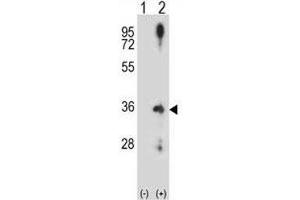 Western blot analysis of Cyclin D2 antibody and 293 cell lysate (2 ug/lane) either nontransfected (Lane 1) or transiently transfected (2) with the CCND2 gene. (Cyclin D2 antibody  (AA 1-30))