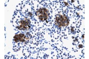ZNF21 antibody was used for immunohistochemistry at a concentration of 4-8 ug/ml to stain Epithelial cells of pancreatic acinus (lndicated with Arrows) in Human Pancreas.