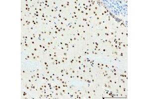 IHC analysis of DDX1 using anti-DDX1 antibody (ABIN7602052). (DDX1 antibody  (AA 562-740))