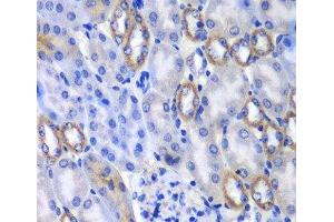 Immunohistochemistry of paraffin-embedded Mouse kidney using MATK Polyclonal Antibody at dilution of 1:100 (40x lens).