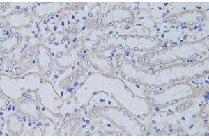 Immunohistochemistry of paraffin-embedded Mouse kidney using AQP5 Polyclonal Antibody at dilution of 1:50 (40x lens). (Aquaporin 5 antibody)