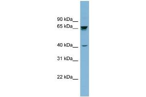 WB Suggested Anti-ACHE Antibody Titration: 0.