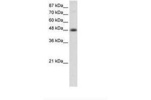 Image no. 1 for anti-Transcription Factor AP-2 beta (Activating Enhancer Binding Protein 2 Beta) (TFAP2B) (AA 372-421) antibody (ABIN202550) (TFAP2B antibody  (AA 372-421))