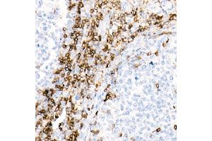 Immunohistochemistry of paraffin-embedded Human tonsil using CD7 antibody (ABIN7266214) at dilution of 1:10000 (40x lens). (CD7 antibody)