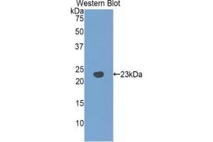 Detection of Recombinant PANX1, Rat using Polyclonal Antibody to Pannexin 1 (PANX1) (PANX1 antibody  (AA 77-260))