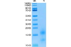 Biotinylated Human BCMA/TNFRSF17 on Tris-Bis PAGE under reduced condition.