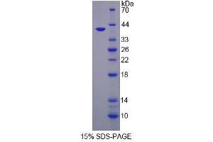 Image no. 1 for Glutaminyl-Peptide Cyclotransferase (QPCT) (AA 29-361) protein (His tag) (ABIN6237206)