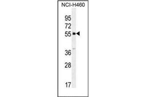 SHISA6 抗体  (N-Term)