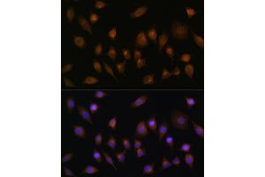 Immunofluorescence analysis of L929 cells using SNX1 Rabbit pAb (ABIN6128725, ABIN6148234, ABIN6148235 and ABIN6224727) at dilution of 100 (40x lens). (Sorting Nexin 1 antibody  (AA 1-150))