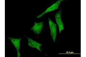 Immunofluorescence of purified MaxPab antibody to RIOK2 on HeLa cell. (RIOK2 antibody  (AA 1-552))