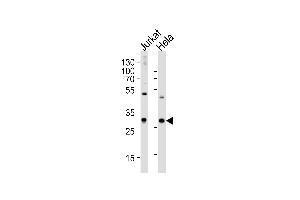 Western blot analysis of lysates from Jurkat, HeLa cell line (from left to right), using CAPZB Antibody at 1:1000 at each lane.