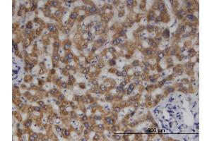 Immunoperoxidase of monoclonal antibody to MCCC2 on formalin-fixed paraffin-embedded human liver. (MCCC2 antibody  (AA 456-563))