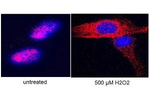 Anti-hTERT Antibody - Immunofluorescence Microscopy  anti hTERT antibody-Immunofluorescence# anti hTERT antibody was used to stain hTERT on hTERT-over-expressing fibroblasts. (TERT antibody  (C-Term))