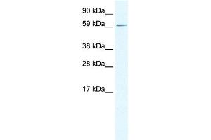 WB Suggested Anti-TGFB1I1 Antibody Titration: 0. (TGFB1I1 antibody  (Middle Region))