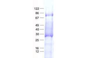 Validation with Western Blot (LZTS1 Protein (His tag))