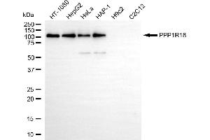 Western blotting analysis using PPP1R18 antibody (ABIN7799196).