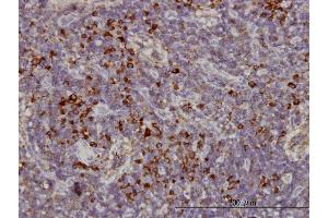 Immunoperoxidase of monoclonal antibody to KIFC1 on formalin-fixed paraffin-embedded human lymph node. (KIFC1 antibody  (AA 53-152))