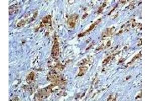 Image no. 1 for anti-Paxillin (PXN) antibody (ABIN271779) (Paxillin antibody)