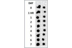 Beta Amyloid HEPES-NaCl aggregation, showing 1/500 (Left) and 1/5000 (Right) time lapse dot blot. (Amyloid Fibrils antibody)