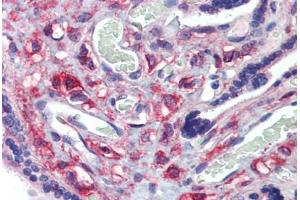 Placenta, Human: Formalin-Fixed, Paraffin-Embedded (FFPE) (KIF20A antibody  (C-Term))