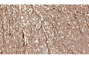 Detection of GFAP in Rat Spinal cord Tissue using Polyclonal Antibody to Glial Fibrillary Acidic Protein (GFAP) (GFAP antibody  (AA 1-430))