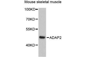 Western blot analysis of extracts of mouse skeletal muscle, using ADAP2 antibody (ABIN6292595) at 1:3000 dilution.