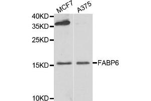 Western blot analysis of extracts of MCF7 and A375 cell lines, using FABP6 antibody.