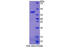 SDS-PAGE analysis of Human GLVR1 Protein. (SLC20A1 Protein)