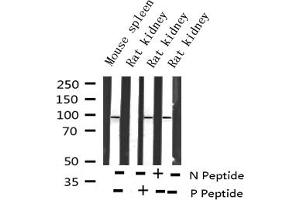 Western Blotting (WB) image for anti-Forkhead Box O3 (FOXO3) (pSer253) antibody (ABIN6255131)