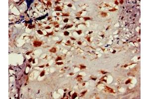 Immunohistochemistry of paraffin-embedded human placenta tissue using ABIN7158837 at dilution of 1:100 (LOXL2 antibody  (AA 27-121))