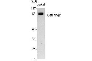 Western Blot analysis of various cells using Catenin-β1 Polyclonal Antibody diluted at 1:1000. (CTNNB1 antibody  (AA 600-680))