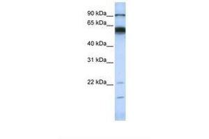 Image no. 1 for anti-Matrix Metallopeptidase 16 (Membrane-inserted) (MMP16) (AA 72-121) antibody (ABIN6738261) (MMP16 antibody  (AA 72-121))