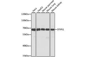 Western blot analysis of extracts of various cell lines, using SYVN1 antibody.