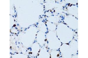 Immunohistochemistry of paraffin-embedded Mouse lung using SPN Polyclonal Antibody at dilution of 1:100 (40x lens). (CD43 antibody)