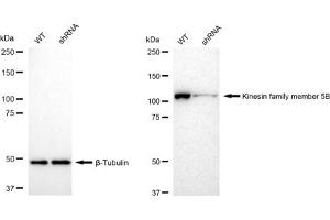 Western blotting analysis using Kinesin family member 5B antibody (ABIN7799208).