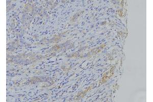 ABIN6273503 at 1/100 staining Human gastric tissue by IHC-P. (Cytochrome b antibody  (N-Term))