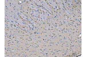 IHC analysis of MST3/STK24 using anti-MST3/STK24 antibody (ABIN7599389). (STK24 antibody  (AA 1-433))