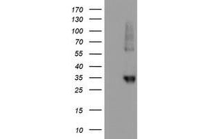 HEK293T cells were transfected with the pCMV6-ENTRY control (Left lane) or pCMV6-ENTRY NPTN (Right lane) cDNA for 48 hrs and lysed. (NPTN antibody)