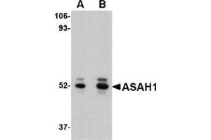 Western blot analysis of ASAH1 in mouse heart tissue lysate with ASAH1 antibody at (A) 1 and (B) 2 μg/ml. (ASAH1 antibody  (C-Term))