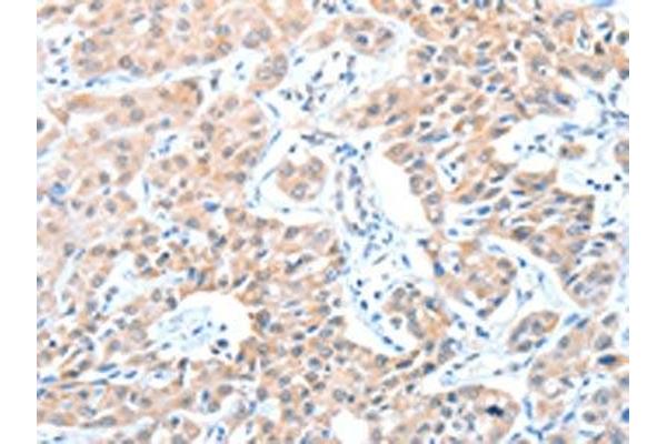 ADAM21 antibody