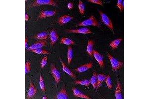 Immunofluorescent analysis of Beta-actin staining in Hela cells.