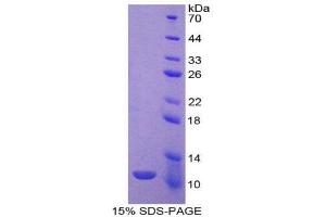 SDS-PAGE (SDS) image for Indoleamine 2,3-Dioxygenase (IDO) (AA 276-360) protein (His tag) (ABIN1170681) (IDO Protein (AA 276-360) (His tag))
