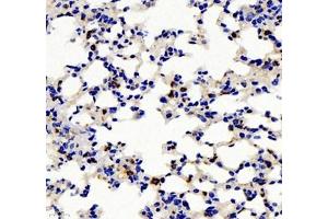 Immunohistochemistry of paraffin embedded mouse pneumonia using IL-2 Receptor alpha (ABIN7074349) at dilution of 1: 500 (400x lens) (CD25 antibody)