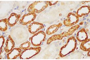 Immunohistochemistry of paraffin-embedded Human kidney using S100A6 Polycloanl Antibody at dilution of 1:150 (S100A6 antibody)