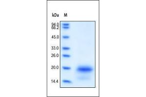 SDS-PAGE (SDS) image for Interleukin 4 (IL4) (AA 25-153) (Active) protein (ABIN2181318)