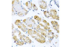 Immunohistochemistry of paraffin-embedded human stomach using RPS2 antibody. (RPS2 antibody  (AA 1-293))