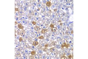 Immunohistochemistry of paraffin-embedded mouse liver using MYO1C antibody (ABIN5974171) at dilution of 1/100 (40x lens). (Myosin IC antibody)