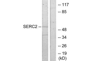Western Blotting (WB) image for anti-serine Incorporator 2 (SERINC2) (C-Term) antibody (ABIN1849918) (SERINC2 antibody  (C-Term))