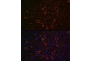 Immunofluorescence analysis of rat brain using SLC5 Rabbit pAb (ABIN7267643) at dilution of 1:100 (40x lens). (ChT antibody  (AA 421-580))